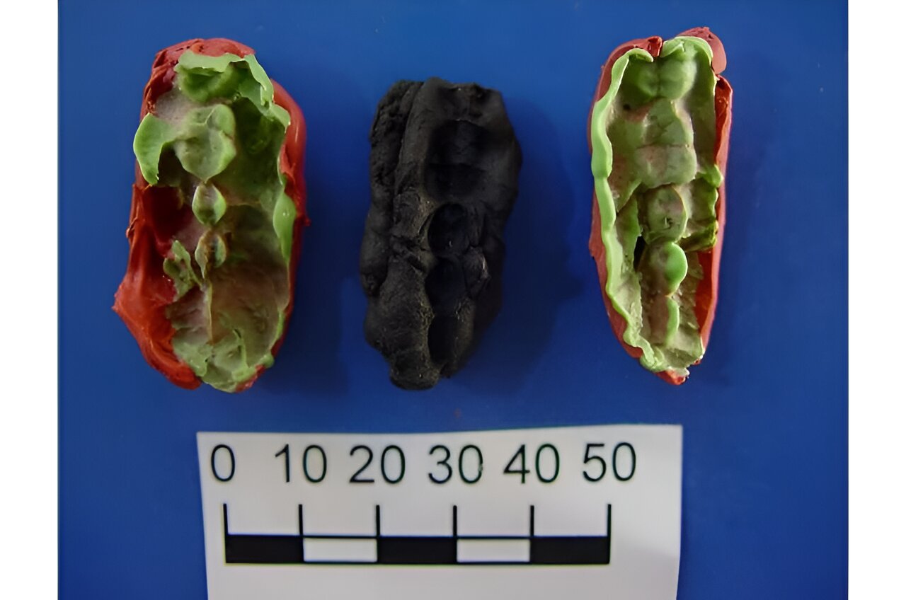 Zubní kámen, parodontóza i poslední jídlo: Žvýkačka s otisky zubů z doby kamenné jako konzerva DNA